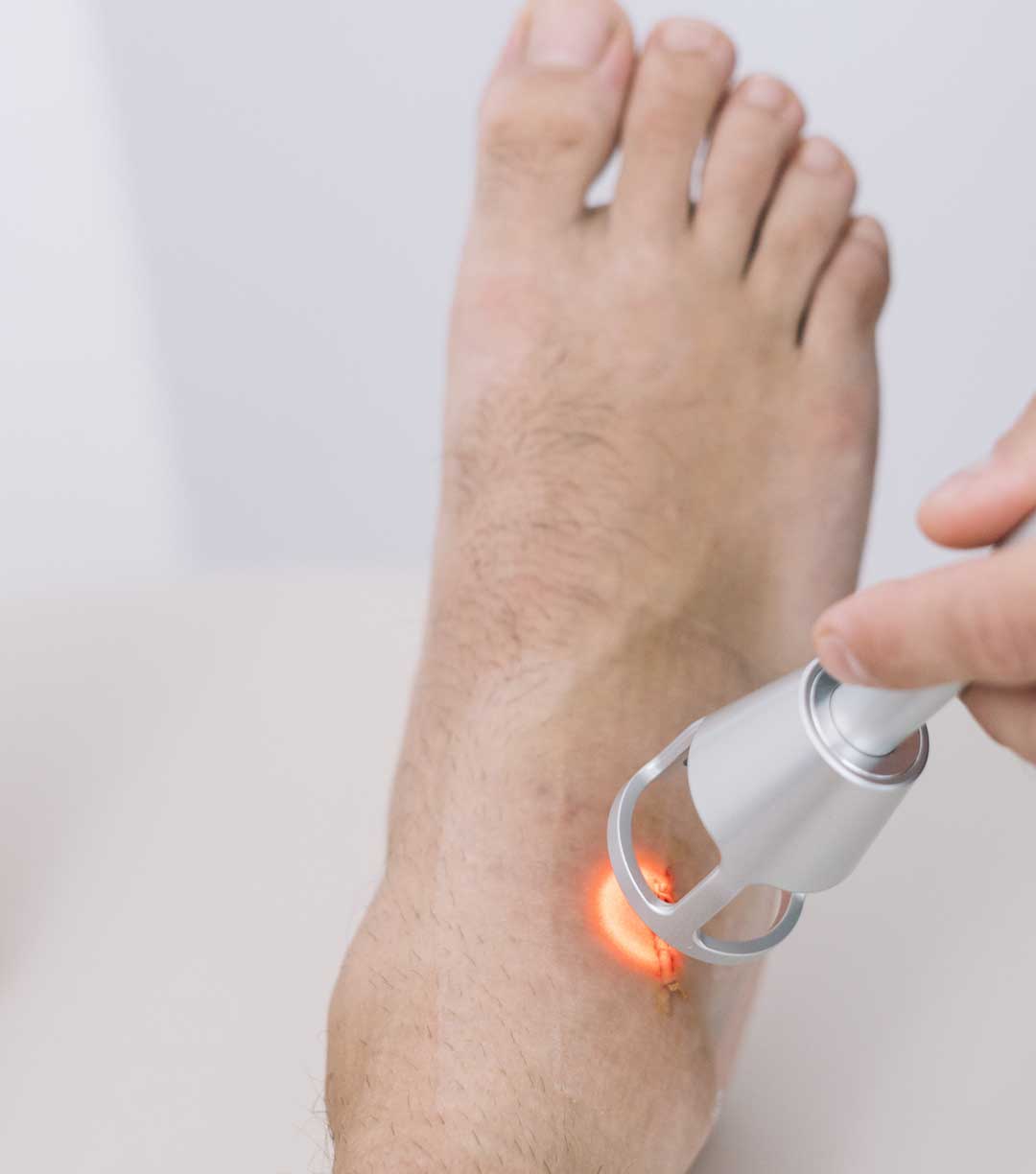 Low-level laser therapy (LLLT)